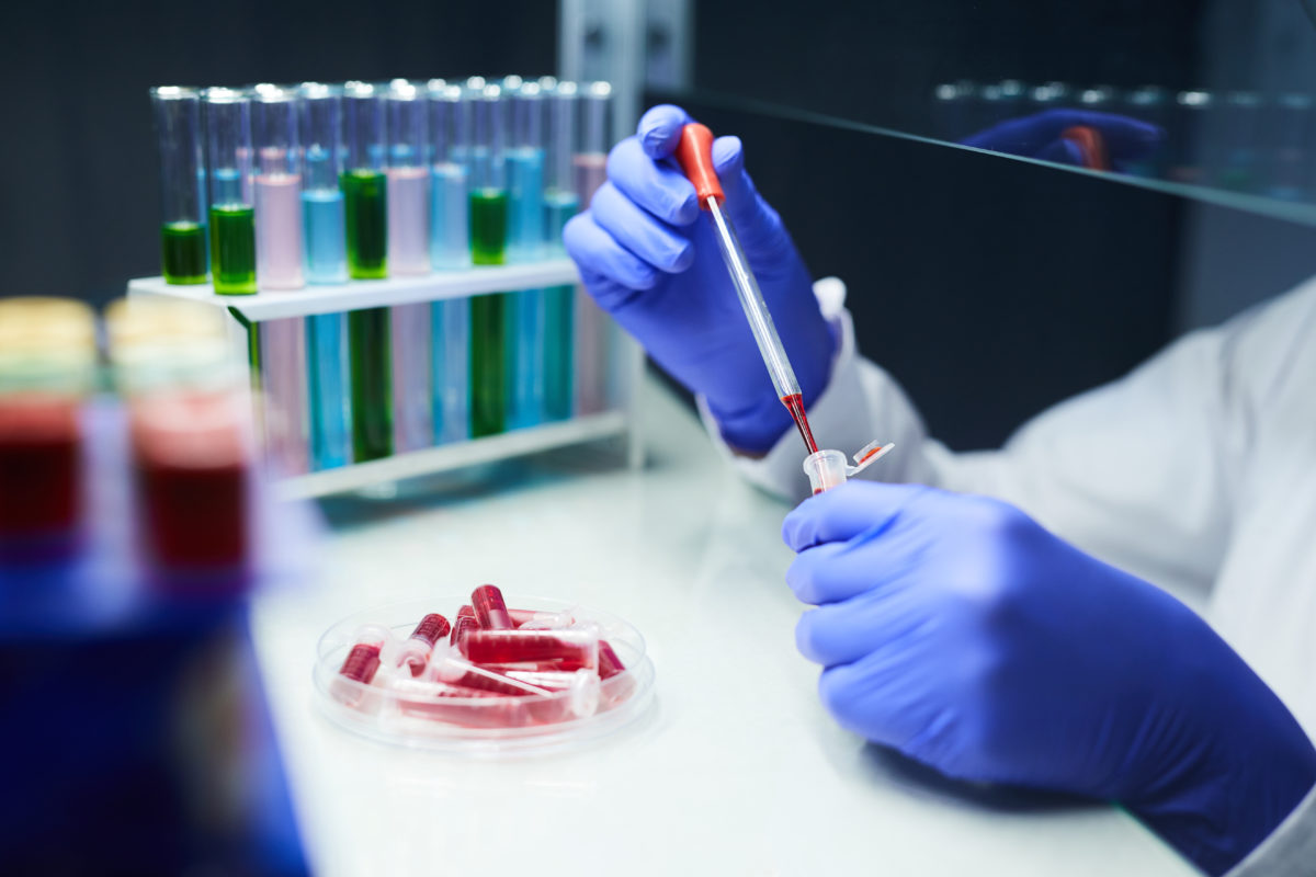 Test in Laboratory