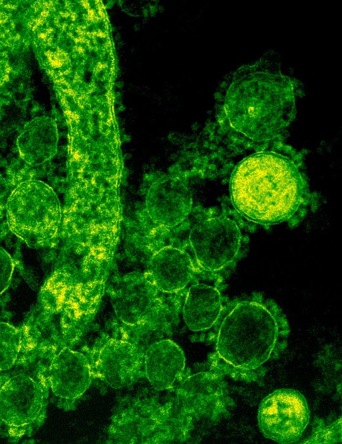 pexels-photo-3992943 microscopic shot of a virus