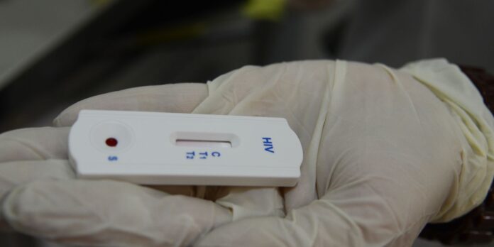 saude-orienta-farmacias-sobre-testes-para-hiv,-sifilis-e-hepatites