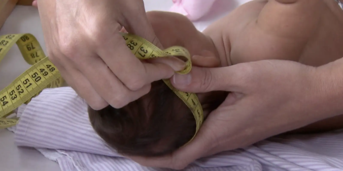 pessoas-com-deficiencia-associada-ao-zika-terao-pensao-vitalicia pessoas-com-deficiencia-associada-ao-zika-terao-pensao-vitalicia